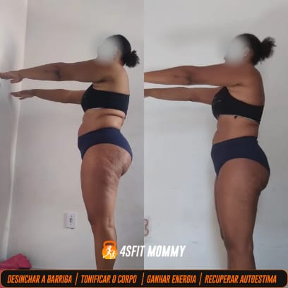 foto de antes e depois-2